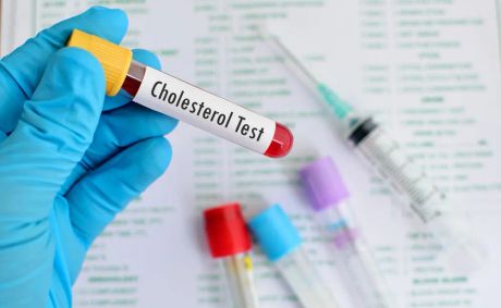 How to lower your cholesterol, 7 lifestyle changes
