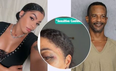 Photos: Charleston White’s Girlfriend Claims Comedian Abused Her, Reportedly Leads To His Arrest