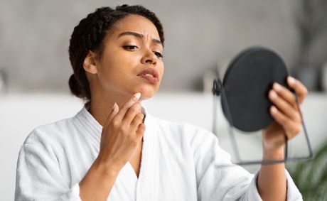 Why you keep getting huge chin pimples when you’re horny