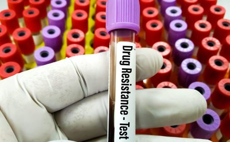 CDC names 19 drug-resistant germs killing Americans