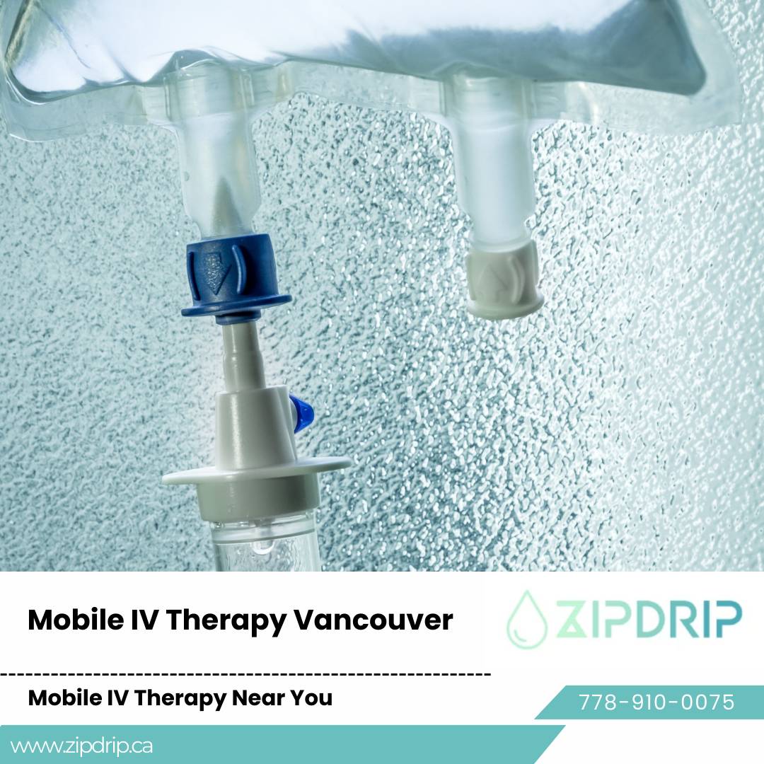 IV Hydration Therapy IV Hydration Therapy Vancouver cost