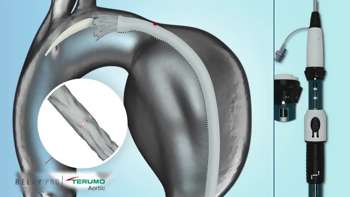 RelayPro Thoracic Aneurysm Stent Graft