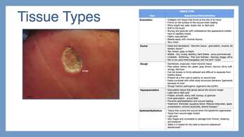 Tissue types