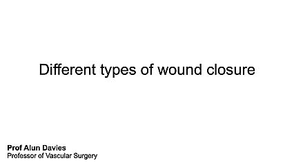 Different types of wound closure  