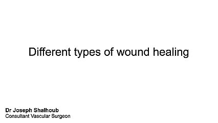Different types of wound healing