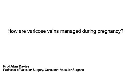 How are Varicose Veins managed during pregnancy?