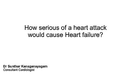 How big a heart attack might lead to Heart Failure?