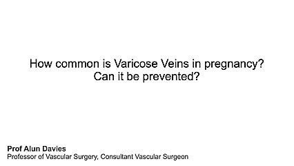 How common are Varicose Veins in pregnancy? Can it be prevented? 