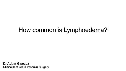 How common is lymphoedema?