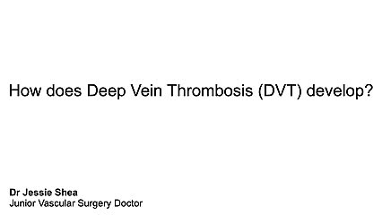 How does DVT develop?