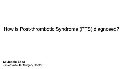 How is PTS diagnosed?