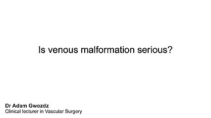 How serious are venous abnormalities?