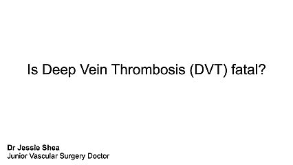 Is DVT fatal?