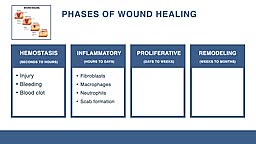 Managing Chronic Wounds.