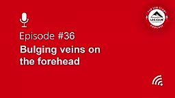 Podcast Episode 36: Bulging Veins on the Forehead
