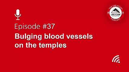 Podcast Episode 37: Bulging blood vessels on the temples