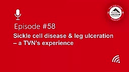Podcast Episode 58: Sickle cell disease and leg ulceration - a TVN's experience