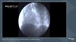 RelayPlus Thoracic Stent Graft 