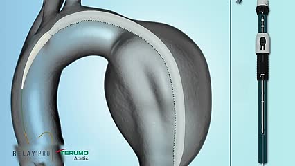 RelayPro Bare Stent 