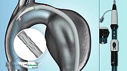 RelayPro Thoracic Aneurysm Stent Graft