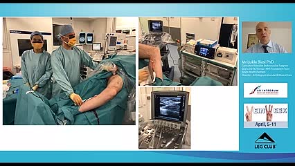 Technology in venous surgery