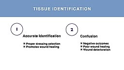 Tissue types