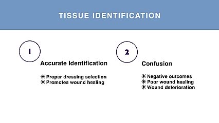 Tissue types