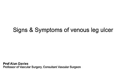 What are the main signs and symptoms of a Venous Leg Ulcer?