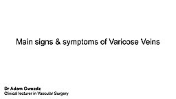 What are the main signs and symptoms of Varicose Veins?