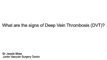 What are the signs of DVT?