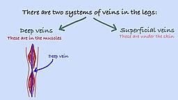 What are varicose veins