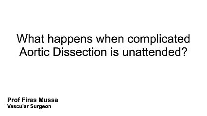 What happen when complicated Aortic Dissection is unattended?