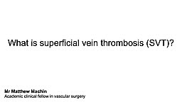 What is superficial vein thrombosis?
