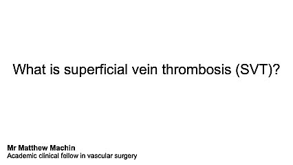 What is superficial vein thrombosis?