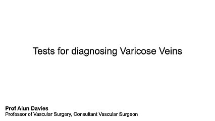 What tests are used to investigate Varicose Veins?