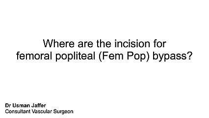 Where are the incision for fem pop bypass?