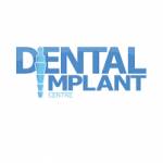 Dental Implant