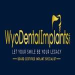 Wyoming Dental Implants