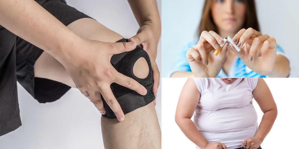 obesity and smoking are the biggest hurdle-in treatment of arthritis, Medical Store Near Me, Buy Medicine Online, Online Pharmacy Noida, Online Medicines, Buy Medicine Online Noida, Nearby Pharmacy, Purchase Medicine Online