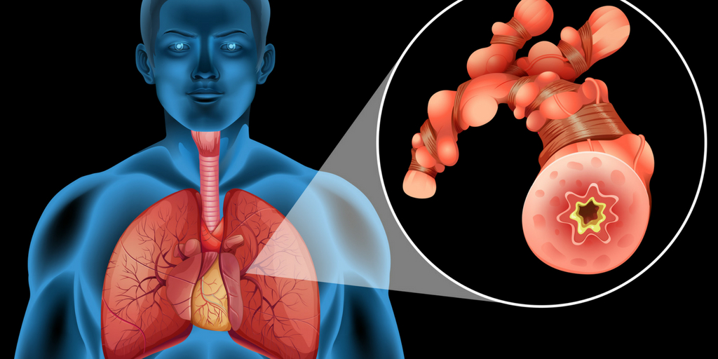 air pollution causing lung cancer among youths, Order Medicine Online Online Pharmacy India Medicine Store Online Medical Store Purchase Medicine Online Medicine Online Online Pharmacy Noida Online Chemist Crossing Republic Online Medicines Buy Medicine Online India Online Pharmacy Gaur City
