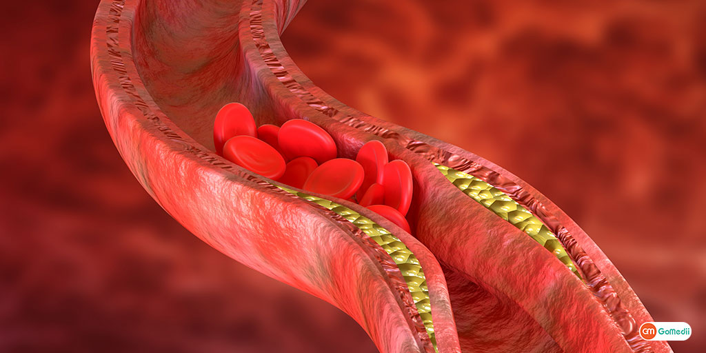 cholesterol ke fayde aur nuksan in hindi