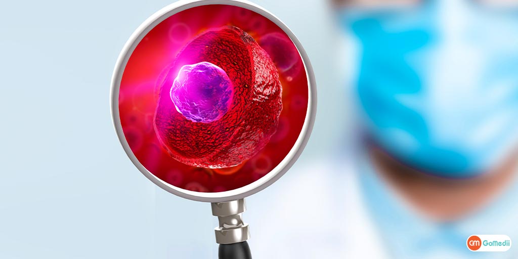 plasma therapy kya hai in hindi
