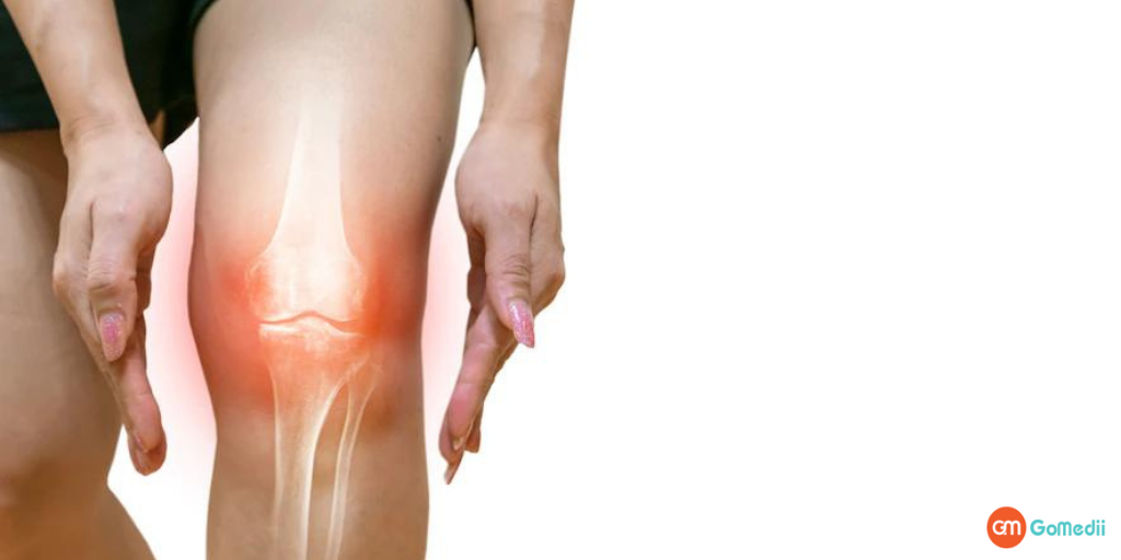 Avascular necrosis क्या है और इसका इलाज कैसे होता है? - GoMedii