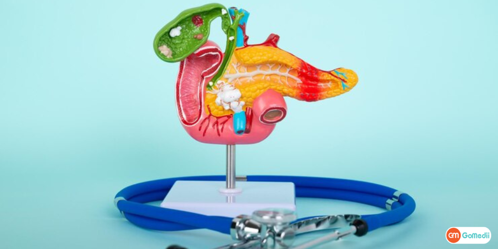 gallbladder cancer ka ilaj aur hospital in hindi - GoMedii