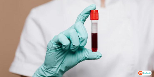 अप्लास्टिक एनीमिया के लिए टेस्ट, (Aplastic Anemia ke liye test in hindi,