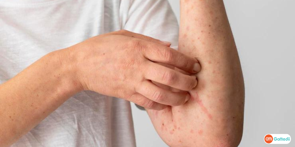 aplastic-anemia-ka-ilaj-in-hindi