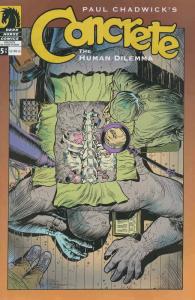 Concrete: The Human Dilemma #5 VF/NM; Dark Horse | save on shipping - details in