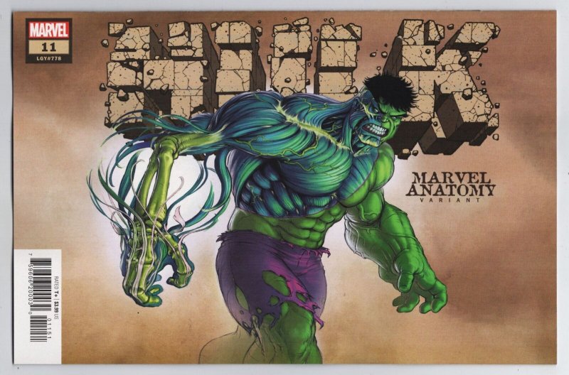 Hulk #11 Jonah Lobe Anatomy Variant (Marvel, 2023) NM