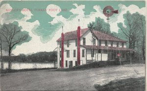 J7/ Turkey Foot Lake Ohio Postcard c1910 Akron Kepler's Hotel 138