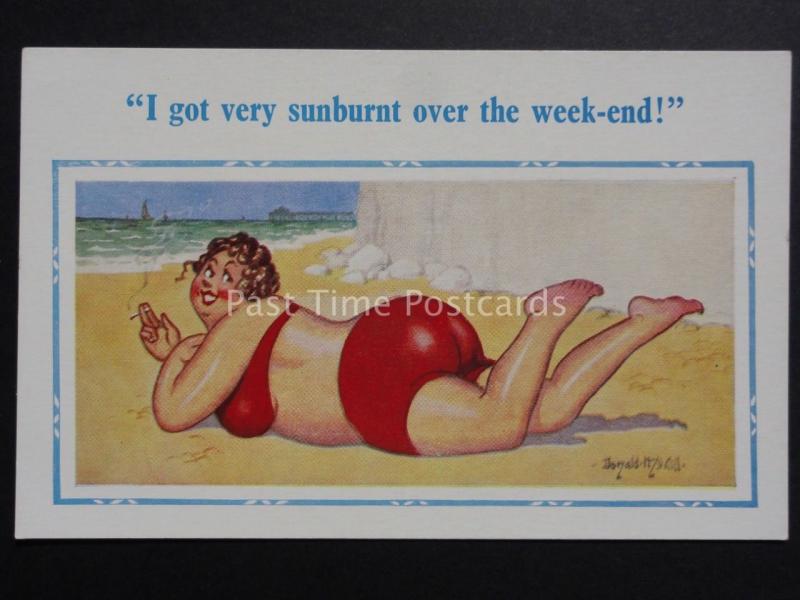 Donald McGill: Large Lady on Beach Smoking Cigarette I GOT SUNBURNT... No.2201